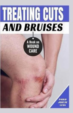 Treating Cuts and Bruises: A Book on Wound Care cover
