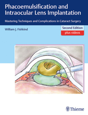 Phacoemulsification and Intraocular Lens Implantation: Mastering Techniques and Complications in Cataract Surgery cover