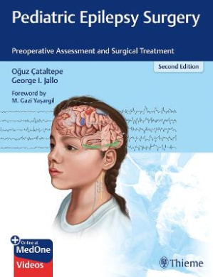 Pediatric Epilepsy Surgery: Preoperative Assessment and Surgical Treatment cover