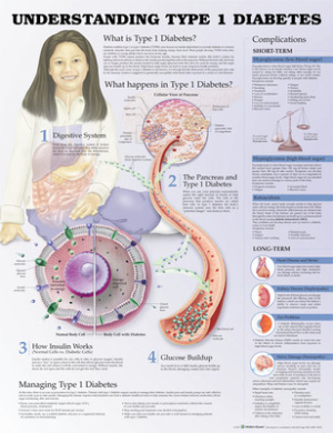 Understanding Type 1 Diabetes Anatomical Chart cover