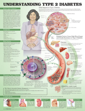 Understanding Type 2 Diabetes Anatomical Chart. Laminated cover